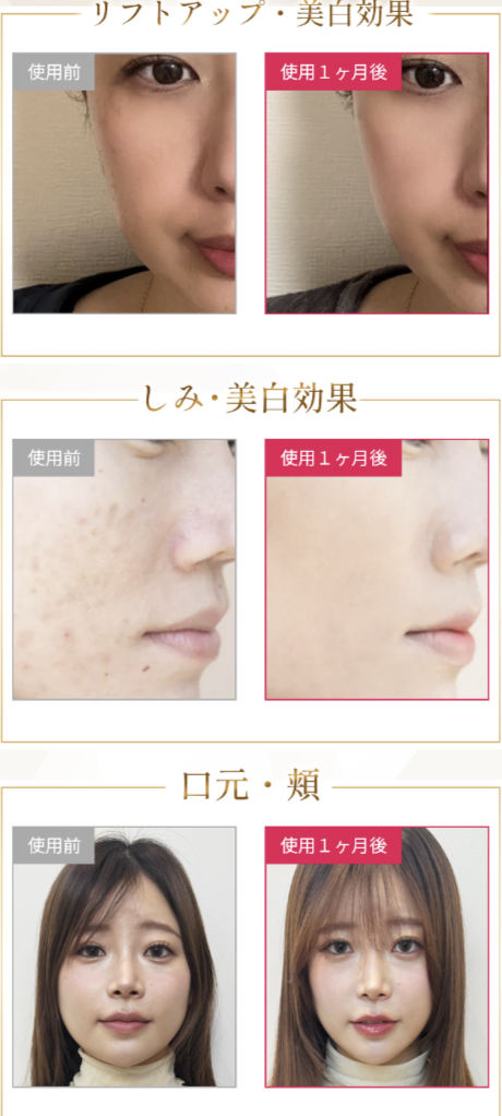 LUJUのケアを実践したお客様の変化